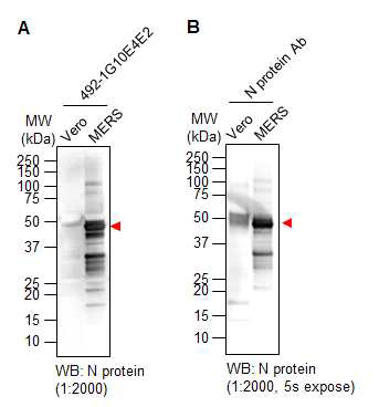 MERS-CoV가 감염된 Vero cell에서 S protein과 결합하는 단백질을 1G10E4E2 단일클론항체를 이용하여 immunoprecipitation 한 후, N protein에 대한 항체를 이용하여 Western blotting으로 확인하였음
