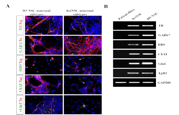 직접교차분화된 신경줄기세포의 다양한 신경세포로의 분화 및 마커 발현 조사
