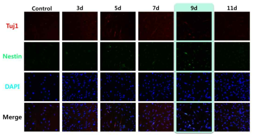 Sox2 유전자가 전달된 인간 체세포에서의 시간경과에 따른 신경세포성 마커 발현 조사