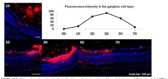 Vitreal and retinal distribution of intravitreally administered DiI loaded LAPMi nanoparticle