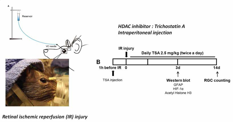 급성 안압상승을 통한 ischemic-reperfusion injury model