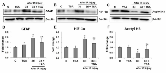 Neuroprotective effect of intraperitoneal trichostatin A