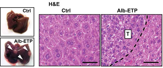 endotrophin을 간세포 특이적으로 과발현시킨 생쥐 모델에서, 외부 스트레스에 의한 간손상이 더욱 심화되며, 암의 발생율이 증가됨을 마커 검증 생쥐모델을 이용하여 확인