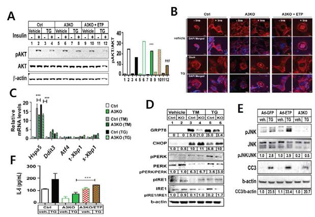 endotrophin의 전구체인 Col6a3 결핍 지방 세포주에 소포체 스트레스 마커 반응성를 확인함. 소포체 스트레스에 의해 결함이 생겼던 인슐린 신호전달과 포도당 수송체인 Glut4의 세포막 이동이 Col6a3 결핍 지방 세포에서는 보호됨을 확인. Col6a3 결핍지방 세포에 endotrophin을 처리했을 때는 다시 소포체 스트레스에 의한 인슐린 신호전달이 감소됨