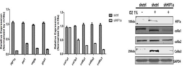 HIF-1a KO 지방세포 모델에서, 저산소증에 의해서 증가되는 Col6a3의 mRNA 및 단백질 발현조절