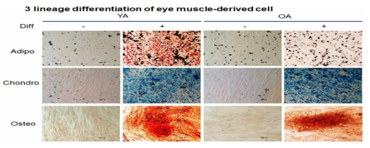 눈 부속 기관 유래 줄기세포의 3 계열 분화능 확인 (논문 준비 중)