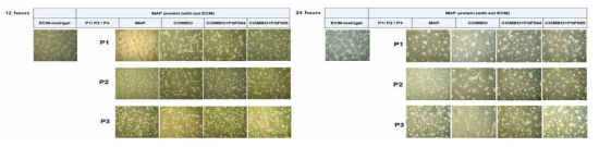 다양한 나노패턴을 이용한 인간 유도만능줄기세포의 부착률 비교 (논문 준비 중)