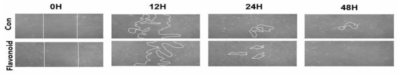 Flavonoid를 처리하여 배양한 Wharton jelly 유래 성체줄기세포의 이동 능력 비교 (논문 준비 중)