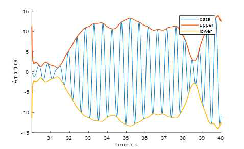 ECoG 진폭 변조(Amplitude Modulation)