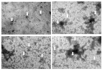 CJLP133 나노소포의 전자현미경 사진, TEM