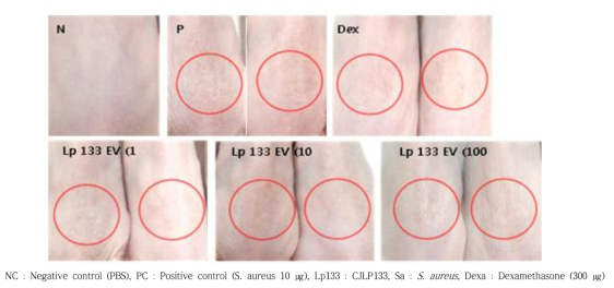 황색포도상구균 (S. aureus) 유래소포에 의한 아토피피부염 마우스모델에서 유산균 유래소포 피부투여 시 육안적인 변화