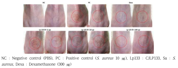 황색포도상구균 (S. aureus) 유래소포에 의한 아토피피부염 마우스모델에서 유산균 유래소포 경구투여 시 육안적인 변화