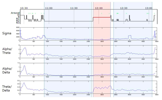 수면 단계별 뇌파 특징 blue box: 2~3단계 수면, red box: REM 수면