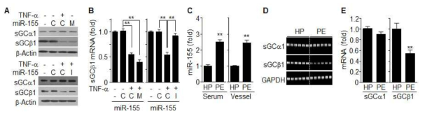 miR-155는 혈관평활근세포에서 sGCβ1의 발현을 억제함