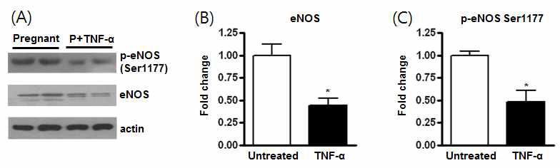 TNF-α에 의한 eNOS 발현과 불활성화