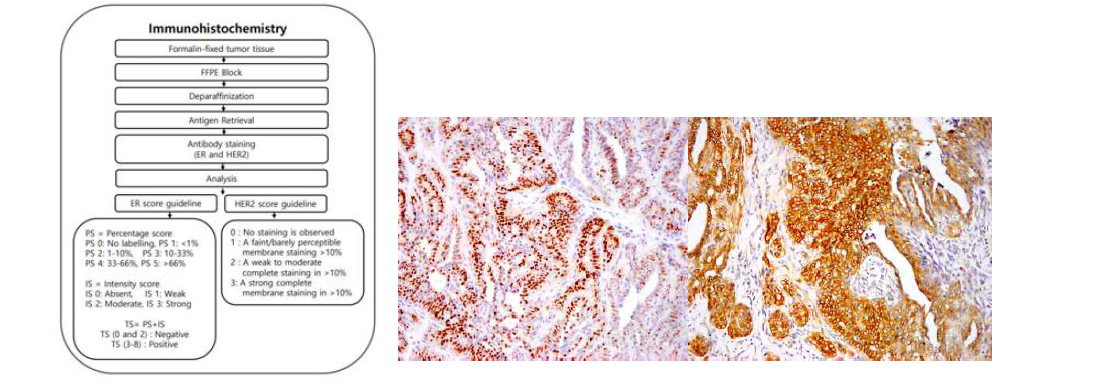 Immunohistochemistry 실험 flow-chart, Estrogen receptor, HER-2 IHC 실험 사진