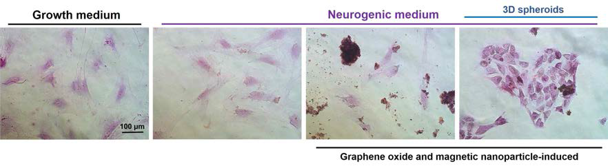그림에 표기된 각각의 조건 하에서 신경 분화를 Nissl body 염색으로 확인한 결과