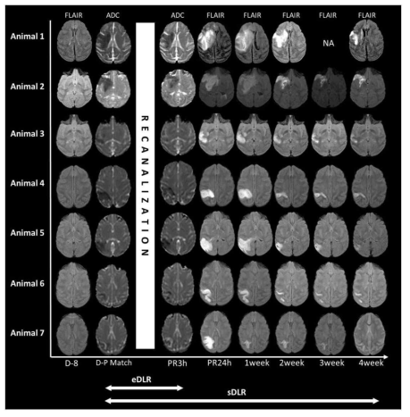 정성적 신경영상의학적 분석을 위한 coregistered serial MR images