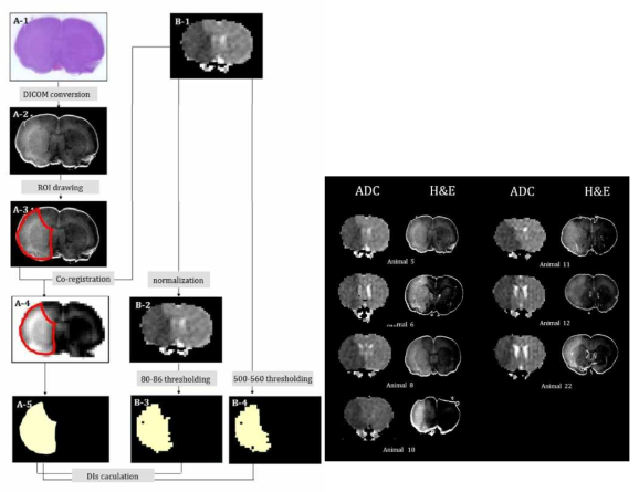 설치류 뇌경색 모델의 정량적 분석을 위한 병리조직과의 비교 검증