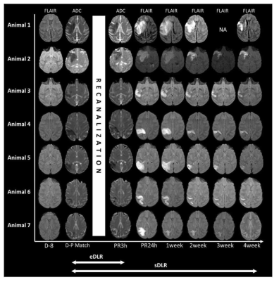 정성적 신경영상의학적 분석을 위한 coregistered serial MR images