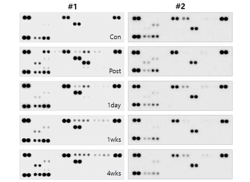 환자 및 원숭이 뇌경색 모델에서 시기별 cytokine array 결과. 인간 뇌경색 환자 시기별 cytokine array (#1)과 원숭이 뇌경색 모델 시기별 cytokine array (#2). 각 혈액 샘플에서 발현되는 cytokine은 spot (●)으로 표시