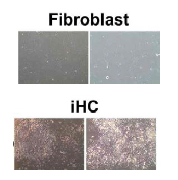 직접교차분화 방법을 통해 체세포에서 유도간세포(iHC)의 제작하고, 전형적인 간세포의 형태관찰함