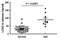 Comparison of plasma LCN2 levels in normal control versus VaD subjects. A statistically significant difference is found in the plasma LCN2 levels between healthy controls (n = 28; 33.37 ± 3.53) and patients with VaD (n = 9; 90.06 ± 12.71) based on an unpaired two‐tailed Student's t test (p < .0001). The horizontal bar in each column indicates the mean values of the LCN2 levels