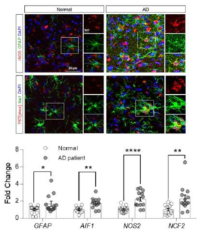 Nitrosative markers were elevated in astrocytes and microglia of Alzheimer’s patient brain
