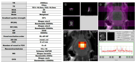 CSI 프로토콜 최적화 및 in vivo 데이터 획득 (①: 다중 복셀 설정, ②: Saturation band (OVS), ③, ④: CSI 데이터)