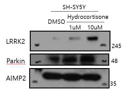 SH-SY5Y 신경세포주에Hydrocortisone 처리 이후 퇴행성 신경질환 관련 단백질 발현 분석