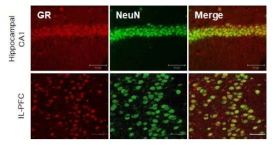 IL-PFC와 CA1에서 GR의 해부학적 구분을 위한 컨포칼 이미징
