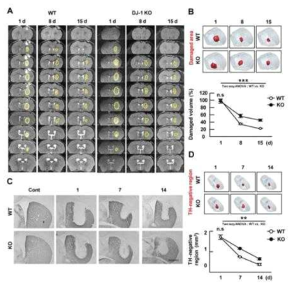 A DJ-1 deficiency delays repair of the injury in the striatum. Brain damage was induced by stereotaxic injection of ATP into the striatum of WT and DJ-1-KO mice. (A) Damage sites were imaged by 9.4T MRI at the indicated times after ATP injection. Serial coronal images were taken every 250 m. Yellow lines indicate damaged regions. (B) Damaged regions (red) were reconstructed by Neurolucida 3D modeling based on MRI images. Damage volumes were calculated. Values are means±SEMs of 3 mice. (C) Brain sections (40 m) were prepared at the indicated times after ATP injection and stained with TH antibodies. The most damaged sections are shown. (D) TH-negative regions (red) were reconstructed by Neurolucida 3D modeling based on TH staining, and volumes were quantified. Values are means±SEMs of 4 mice (D). n.s, nonsignificant from unpaired two tailed t-test (C, E); **, P<0.005; ***, P<0.0001 from Two-way ANOVA (C, E). Scale bar, 1 mm (C)