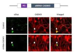 타겟단백질 (CADM3) shRNA모식도(위), shRNA를 세포에 주입하여 타겟단백질의 효과적 발현저해를 면역형광법으로 확인함 (아래)