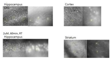 Hippocampus, cortex, striatum