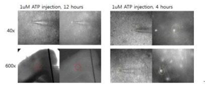 ATP 손상모델에서 SR101 염색 및 DIC 이미지