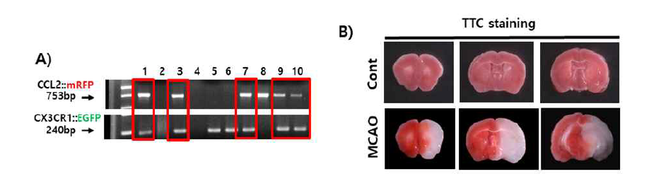 이중염증형광표지 마우스 유전형질 및 뇌허혈 손상 분석