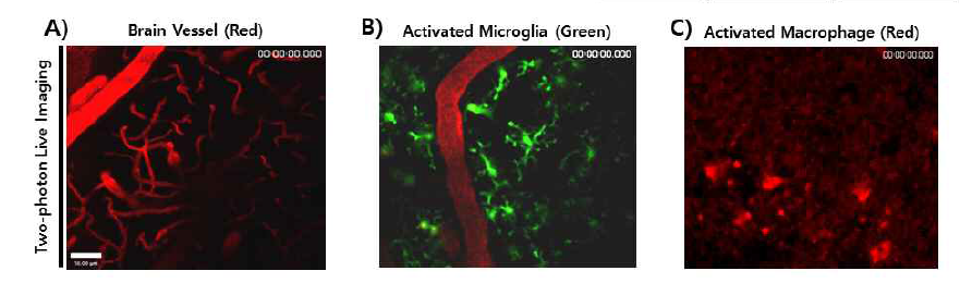 이광자현미경을 이용하여 뇌혈관 및 뇌염증 관여 세포 관찰