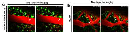 실시간 뇌염증 관여 미세아교세포 관찰