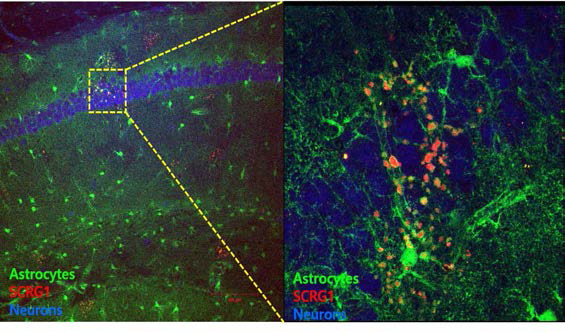 알츠하이머 병모델 쥐 뇌에서 존재하는 별아교세포에서 선택적으로 발현 증가하는 SCRG1