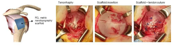 생분해성 힘줄 모사형 나노 지지체를 이용한 동물 모델 어깨 극상건 보강술