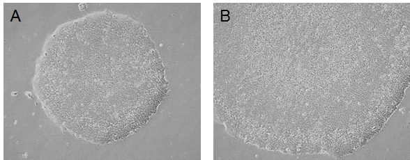 재조합 단백질 PLGA-FGF2를 포함한 homemade E8 basal medium에서 2주 동안 배양한 인간 배아줄기세포 H9(WA09) hESCs의 morphology