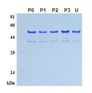 봉입체 내의 His8-tVTN 분리 및 수용화, P: pellet fraction, U: Urea로 수용화시킨 단백질