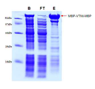 MBP-truncated Vitronectin-MBP fusin 단백질 정제, B: 컬럼에 결합시키기 전의 단백질, FT: 컬럼에 결합하지않은 단백질, E : 20 mM Maltose 포함 용액에서 elution된 단백질