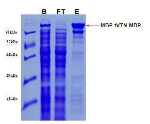MBP-tVTN-MBP 정제, B: 컬럼에 결합시키기 전의 단백질, FT: 컬럼에 결합지않은 단백질, E: 20 mM Maltose 포함 용액에서 elution된 단백질