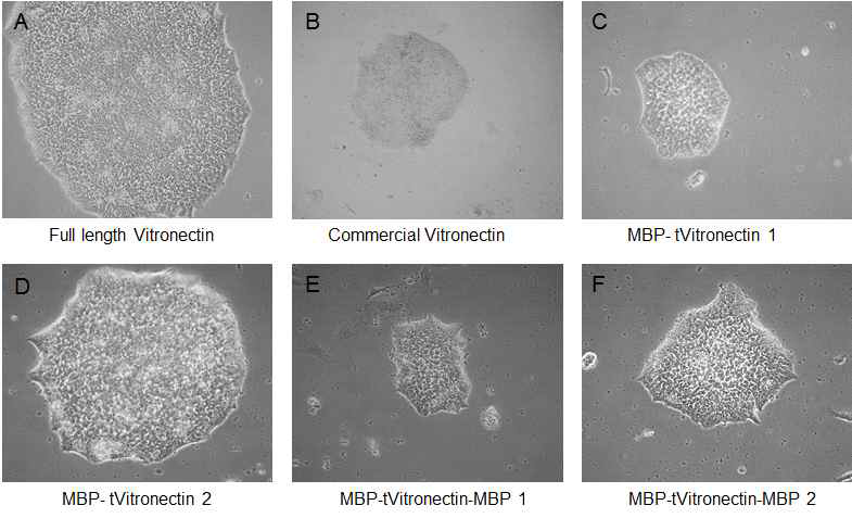 재조합 단백질 vitronectin, Full length vitronectin, MBP-tVitronectin, MBP-tVitronectin_MBP 코팅 위에서 homemade E8 basal medium을 사용하여 배양한 인간 배아 줄기세포 H9(WA09) hESCs의 morphology