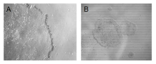 Homemade E8 medium에서 배양한 인간 배아줄기세포 H9(WA09) hESCs의 morphology