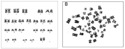 인간 배아줄기세포 H9(WA09)를 homemade E8 medium에서 10회 계대배양 후 karyotyping analysis를 진행함