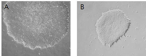 인간 배아줄기세포 H9(WA09)를 DJ1 단백질을 포함한 homemade E8 basal medium에서 10회 계대 배양후의 morphology