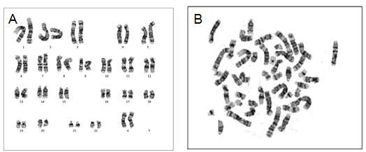 인간 배아줄기세포 H9(WA09)를 DJ1 단백질을 포함한 homemade E8 basal medium에서 10회 계대 배양후 karyotyping analysis를 진행함