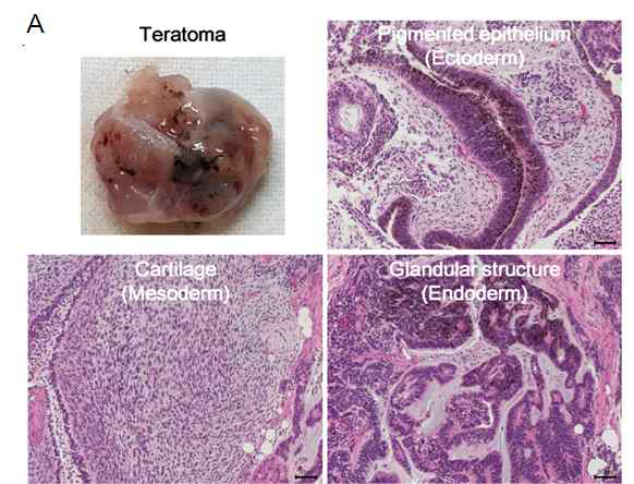 생체내 형성된 teratoma와 3배엽 분화 구조